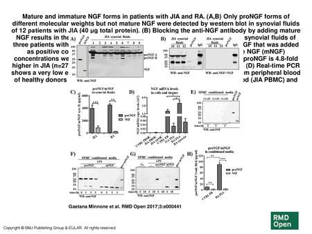 Mature and immature NGF forms in patients with JIA and RA
