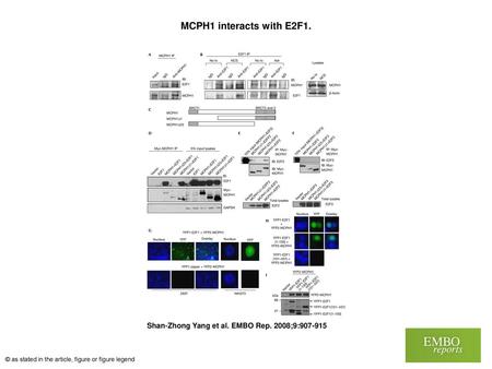 MCPH1 interacts with E2F1. MCPH1 interacts with E2F1. (A,B) HEK293 cells were left untreated (No tx) or treated with 300 ng/ml NCS for 4 h or 2 μM adriamycin.