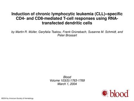 Induction of chronic lymphocytic leukemia (CLL)–specific CD4- and CD8-mediated T-cell responses using RNA-transfected dendritic cells by Martin R. Müller,