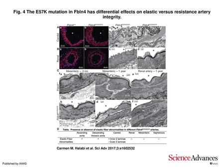 Fig. 4 The E57K mutation in Fbln4 has differential effects on elastic versus resistance artery integrity. The E57K mutation in Fbln4 has differential effects.