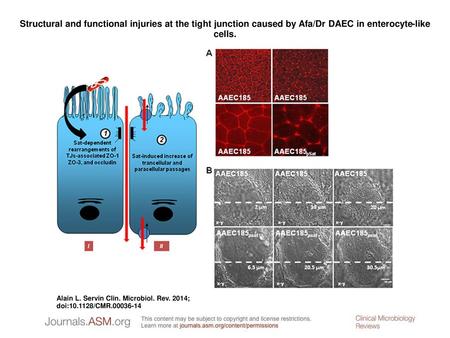Structural and functional injuries at the tight junction caused by Afa/Dr DAEC in enterocyte-like cells. Structural and functional injuries at the tight.