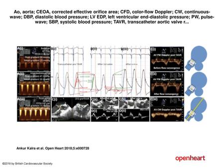 Ao, aorta; CEOA, corrected effective orifice area; CFD, color-flow Doppler; CW, continuous-wave; DBP, diastolic blood pressure; LV EDP, left ventricular.