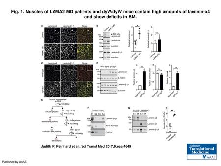 Fig. 1. Muscles of LAMA2 MD patients and dyW/dyW mice contain high amounts of laminin-α4 and show deficits in BM. Muscles of LAMA2 MD patients and dyW/dyW.
