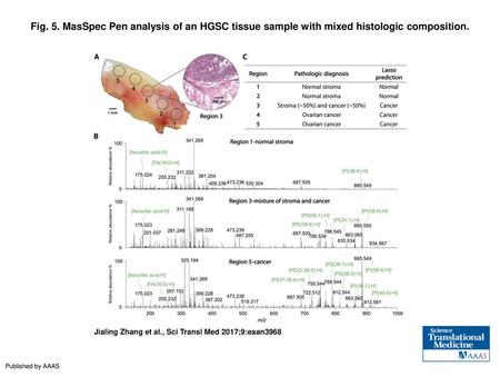 Fig. 5. MasSpec Pen analysis of an HGSC tissue sample with mixed histologic composition. MasSpec Pen analysis of an HGSC tissue sample with mixed histologic.