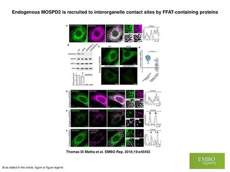 Endogenous MOSPD2 is recruited to interorganelle contact sites by FFAT‐containing proteins Endogenous MOSPD2 is recruited to interorganelle contact sites.