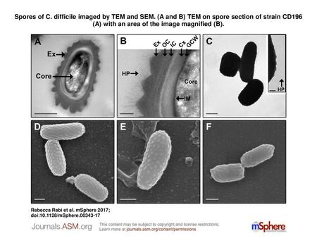Spores of C. difficile imaged by TEM and SEM