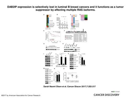 DAB2IP expression is selectively lost in luminal B breast cancers and it functions as a tumor suppressor by affecting multiple RAS isoforms. DAB2IP expression.