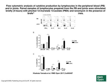 Flow cytometric analysis of cytokine production by lymphocytes in the peripheral blood (PB) and in joints. Paired samples of lymphocytes prepared from.