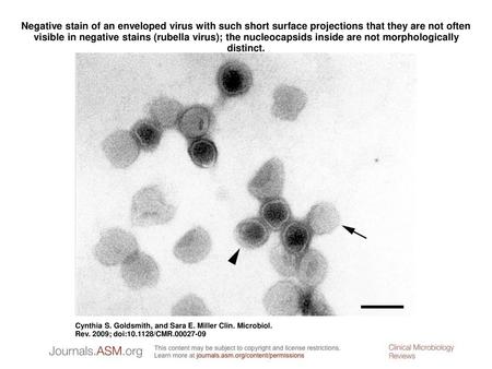 Negative stain of an enveloped virus with such short surface projections that they are not often visible in negative stains (rubella virus); the nucleocapsids.