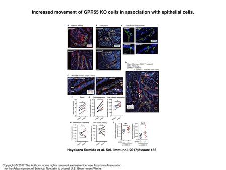 Increased movement of GPR55 KO cells in association with epithelial cells. Increased movement of GPR55 KO cells in association with epithelial cells. (A)