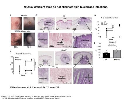 NFATc2-deficient mice do not eliminate skin C. albicans infections.