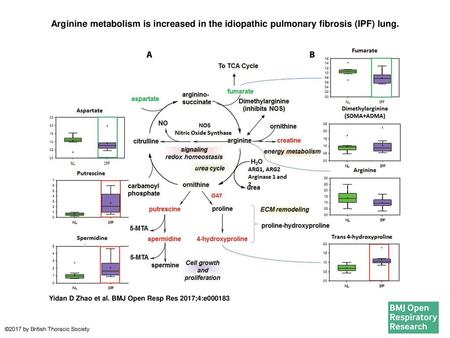 Arginine metabolism is increased in the idiopathic pulmonary fibrosis (IPF) lung. Arginine metabolism is increased in the idiopathic pulmonary fibrosis (IPF)