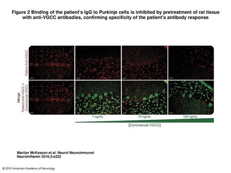 Figure 2 Binding of the patient's IgG to Purkinje cells is inhibited by pretreatment of rat tissue with anti-VGCC antibodies, confirming specificity of.