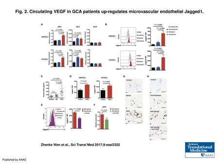 Fig. 2. Circulating VEGF in GCA patients up-regulates microvascular endothelial Jagged1. Circulating VEGF in GCA patients up-regulates microvascular endothelial.