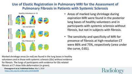 Use of Elastic Registration in Pulmonary MRI for the Assessment of Pulmonary Fibrosis in Patients with Systemic Sclerosis Areas of marked lung shrinkage.