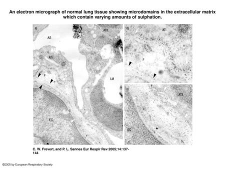 An electron micrograph of normal lung tissue showing microdomains in the extracellular matrix which contain varying amounts of sulphation. An electron.