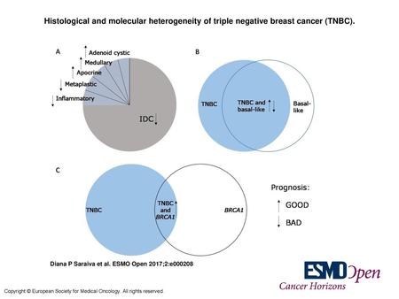 Histological and molecular heterogeneity of triple negative breast cancer (TNBC). Histological and molecular heterogeneity of triple negative breast cancer (TNBC).