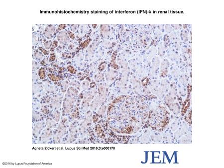 Immunohistochemistry staining of interferon (IFN)-λ in renal tissue.