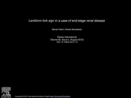 Lentiform fork sign in a case of end-stage renal disease
