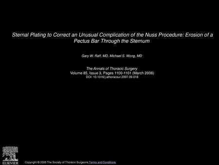 Sternal Plating to Correct an Unusual Complication of the Nuss Procedure: Erosion of a Pectus Bar Through the Sternum  Gary W. Raff, MD, Michael S. Wong,