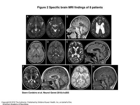 Figure 2 Specific brain MRI findings of 8 patients
