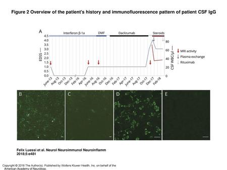 Figure 2 Overview of the patient's history and immunofluorescence pattern of patient CSF IgG Overview of the patient's history and immunofluorescence pattern.