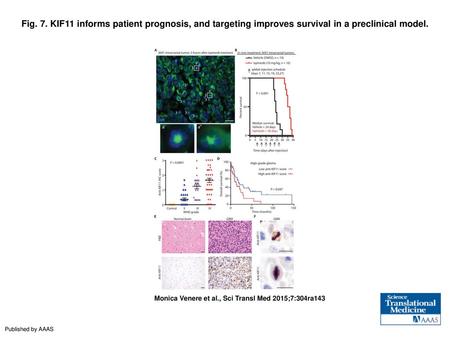 Fig. 7. KIF11 informs patient prognosis, and targeting improves survival in a preclinical model. KIF11 informs patient prognosis, and targeting improves.