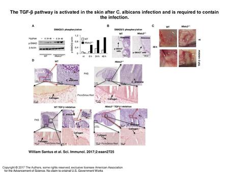 The TGF-β pathway is activated in the skin after C