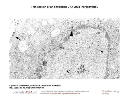 Thin section of an enveloped DNA virus (herpesvirus).