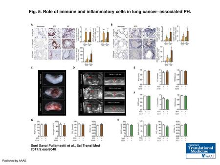 Role of immune and inflammatory cells in lung cancer–associated PH
