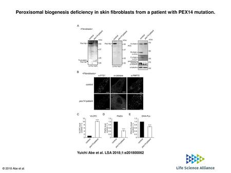 Peroxisomal biogenesis deficiency in skin fibroblasts from a patient with PEX14 mutation. Peroxisomal biogenesis deficiency in skin fibroblasts from a.