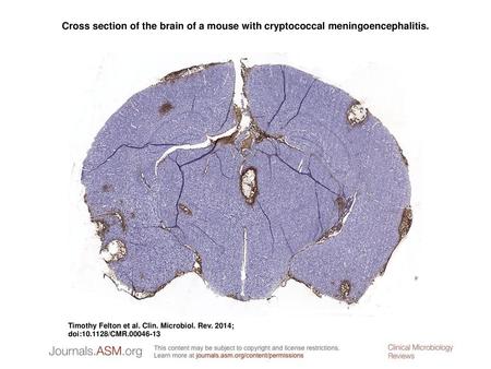 Cross section of the brain of a mouse with cryptococcal meningoencephalitis. Cross section of the brain of a mouse with cryptococcal meningoencephalitis.