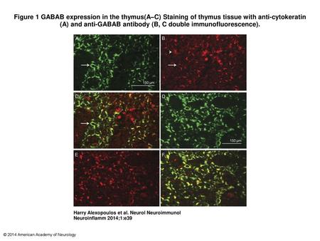 Figure 1 GABAB expression in the thymus(A–C) Staining of thymus tissue with anti-cytokeratin (A) and anti-GABAB antibody (B, C double immunofluorescence).