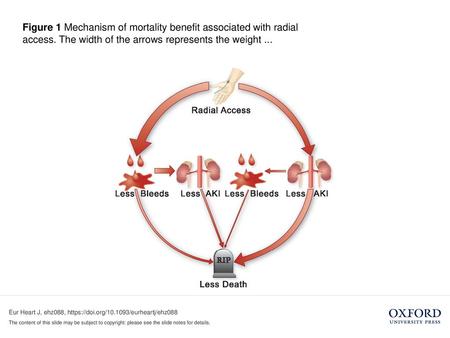 Figure 1 Mechanism of mortality benefit associated with radial access
