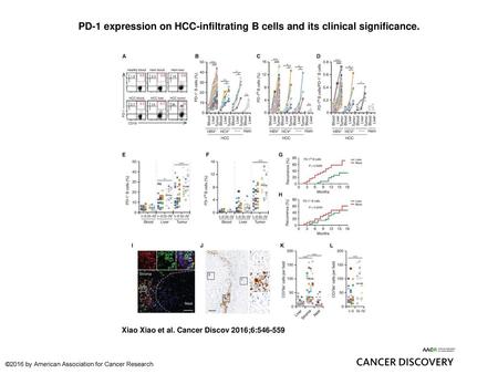 PD-1 expression on HCC-infiltrating B cells and its clinical significance. PD-1 expression on HCC-infiltrating B cells and its clinical significance. A–H,