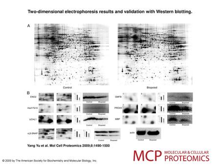 Two-dimensional electrophoresis results and validation with Western blotting. Two-dimensional electrophoresis results and validation with Western blotting.