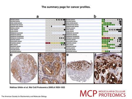 The summary page for cancer profiles.