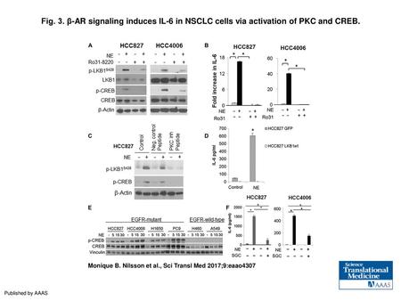 Fig. 3. β-AR signaling induces IL-6 in NSCLC cells via activation of PKC and CREB. β-AR signaling induces IL-6 in NSCLC cells via activation of PKC and.