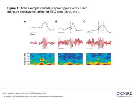 Figure 1 Three example candidate spike ripple events