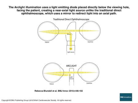 The Arclight illumination uses a light emitting diode placed directly below the viewing hole, facing the patient, creating a near-axial light source unlike.