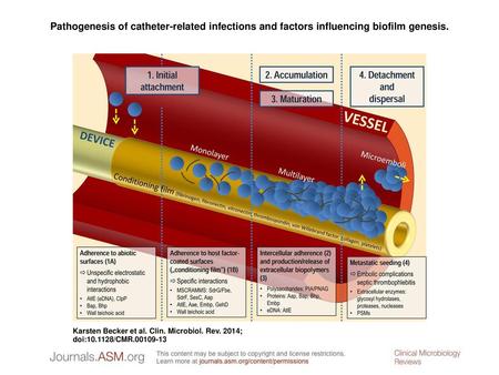 Pathogenesis of catheter-related infections and factors influencing biofilm genesis. Pathogenesis of catheter-related infections and factors influencing.
