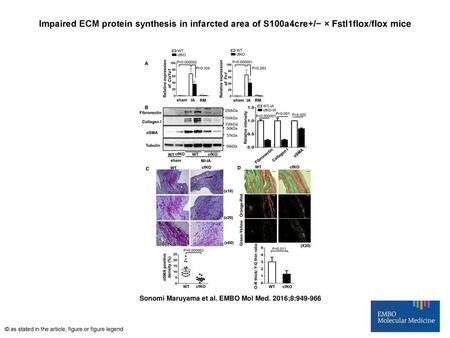 Impaired ECM protein synthesis in infarcted area of S100a4cre+/− × Fstl1flox/flox mice Impaired ECM protein synthesis in infarcted area of S100a4cre+/−