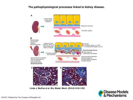 The pathophysiological processes linked to kidney disease.