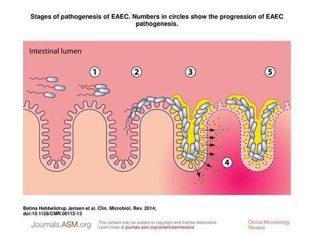 Stages of pathogenesis of EAEC