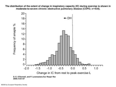 The distribution of the extent of change in inspiratory capacity (IC) during exercise is shown in moderate-to-severe chronic obstructive pulmonary disease.