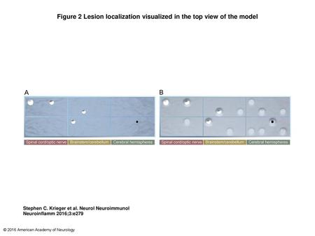 Figure 2 Lesion localization visualized in the top view of the model