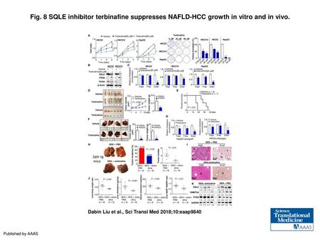 Fig. 8 SQLE inhibitor terbinafine suppresses NAFLD-HCC growth in vitro and in vivo. SQLE inhibitor terbinafine suppresses NAFLD-HCC growth in vitro and.