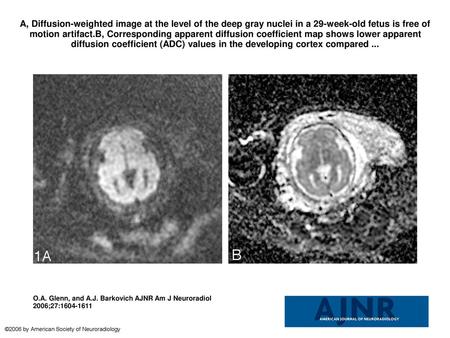 A, Diffusion-weighted image at the level of the deep gray nuclei in a 29-week-old fetus is free of motion artifact.B, Corresponding apparent diffusion.