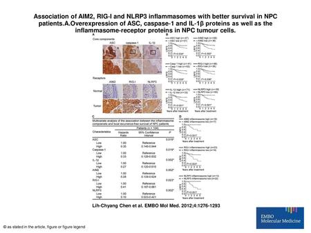 Association of AIM2, RIG‐I and NLRP3 inflammasomes with better survival in NPC patients.A.Overexpression of ASC, caspase‐1 and IL‐1β proteins as well as.