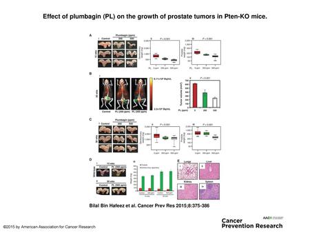 Effect of plumbagin (PL) on the growth of prostate tumors in Pten-KO mice. Effect of plumbagin (PL) on the growth of prostate tumors in Pten-KO mice. A.